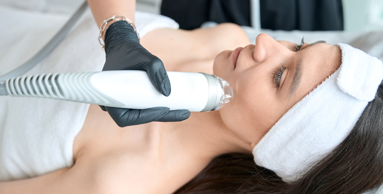 Microneedling Radiofrequenz