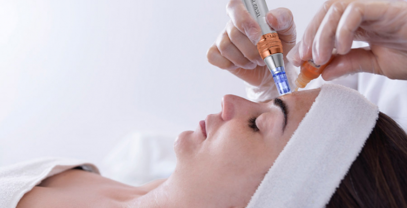 Was ist Microneedling